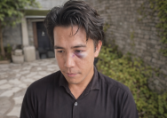 Kepala Kepolisian Resor (Kapolres) Maros AKBP Douglas Mahendrajaya menjadi sorotan publik menyusul kasus penganiayaan terhadap seorang warga bernama Akbar yang diduga dilakukan oleh oknum anggota Polres Maros di kawasan Pantai Tak Berombak (PTB), Kabupaten Maros, Sulawesi Selatan.